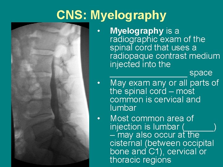 CNS: Myelography • • • Myelography is a radiographic exam of the spinal cord