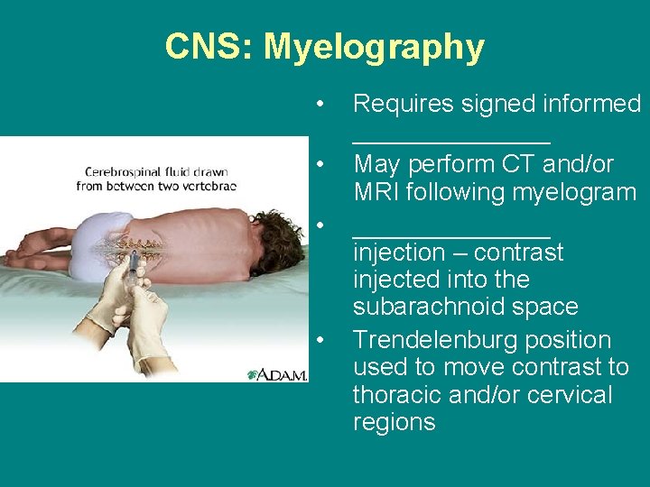 CNS: Myelography • • Requires signed informed _______ May perform CT and/or MRI following