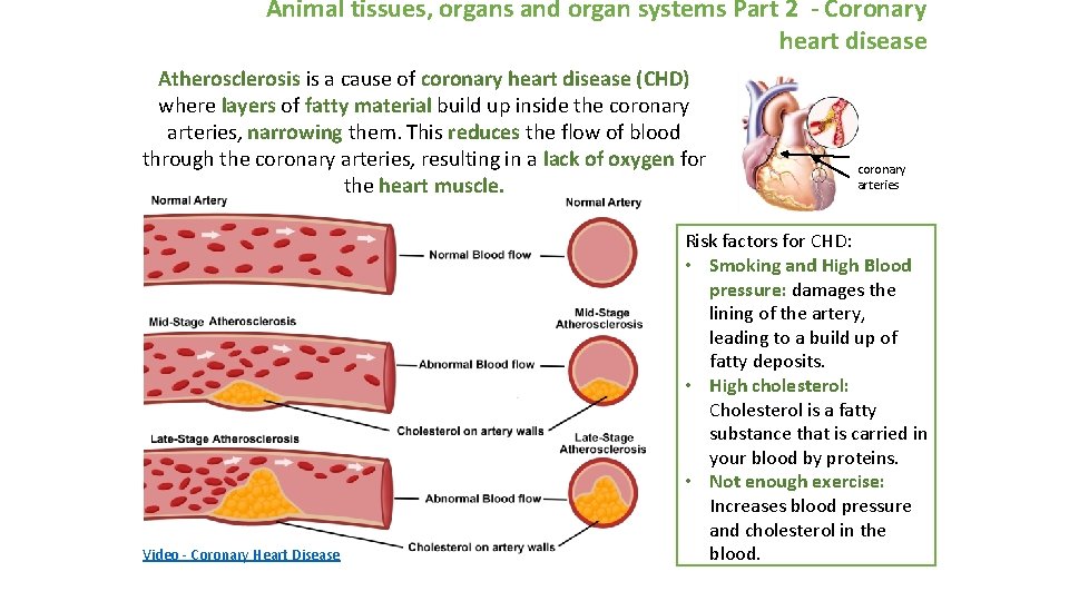 Animal tissues, organs and organ systems Part 2 - Coronary heart disease Atherosclerosis is