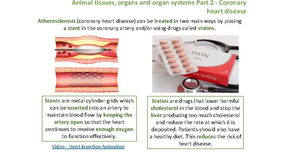Animal tissues, organs and organ systems Part 2 - Coronary heart disease Atherosclerosis (coronary