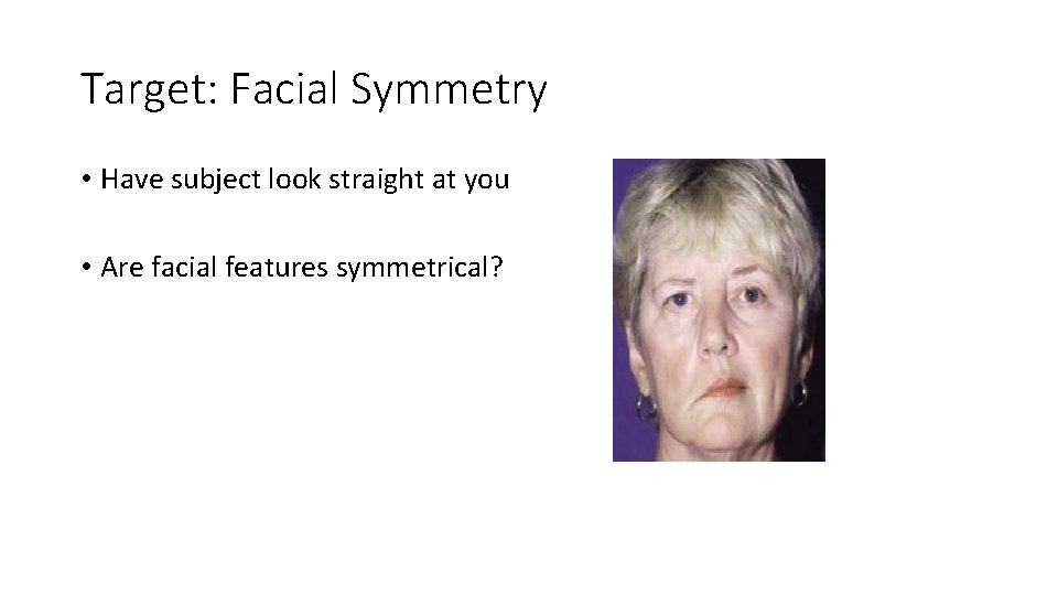 Target: Facial Symmetry • Have subject look straight at you • Are facial features