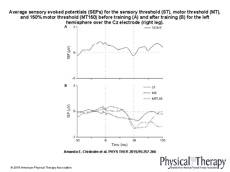 Average sensory evoked potentials (SEPs) for the sensory threshold (ST), motor threshold (MT), and