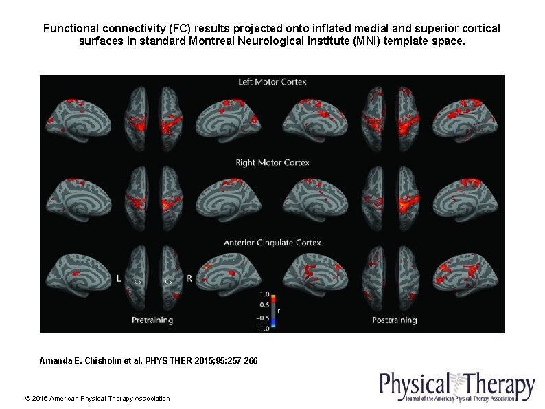 Functional connectivity (FC) results projected onto inflated medial and superior cortical surfaces in standard