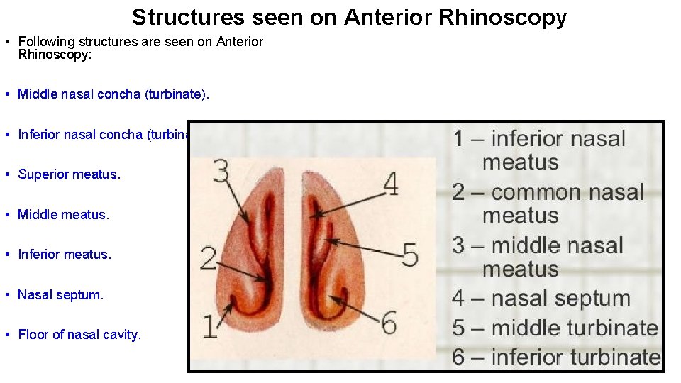 Structures seen on Anterior Rhinoscopy • Following structures are seen on Anterior Rhinoscopy: •