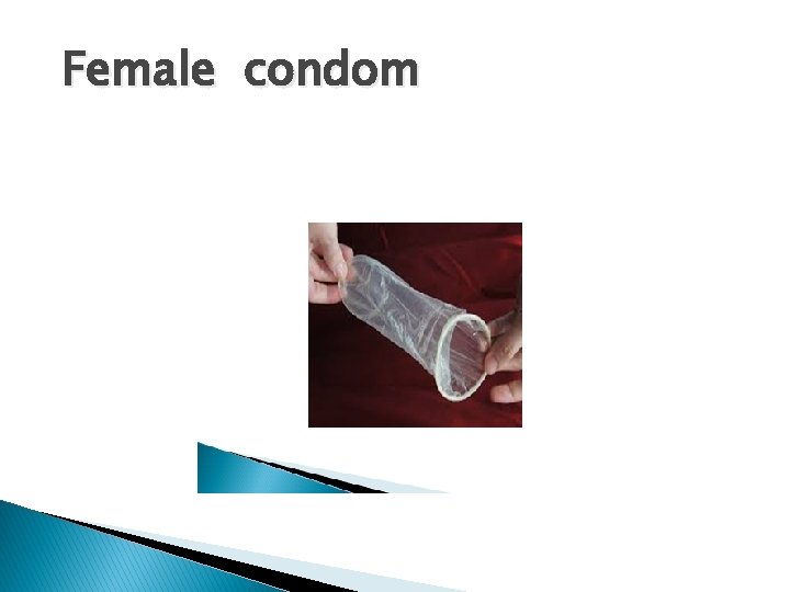 Female condom 