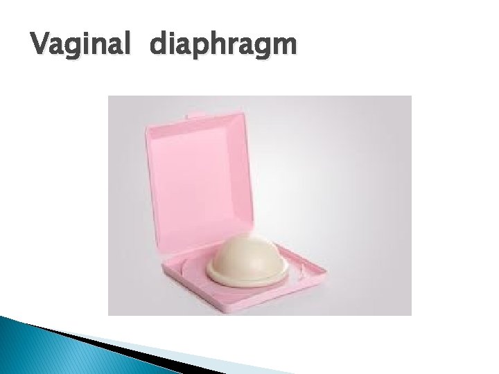 Vaginal diaphragm 