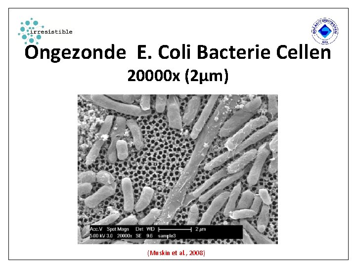 Ongezonde E. Coli Bacterie Cellen 20000 x (2µm) (Muskin et al. , 2008) 