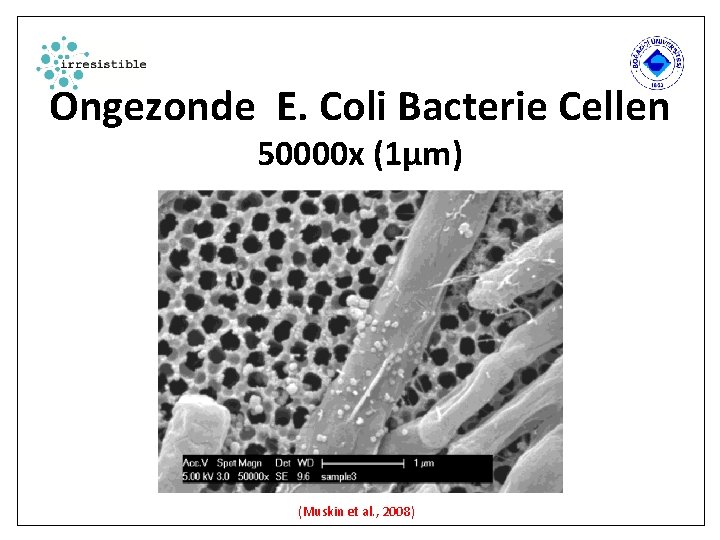 Ongezonde E. Coli Bacterie Cellen 50000 x (1µm) (Muskin et al. , 2008) 