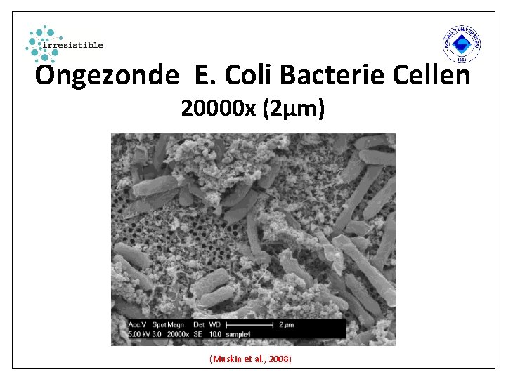 Ongezonde E. Coli Bacterie Cellen 20000 x (2µm) (Muskin et al. , 2008) 