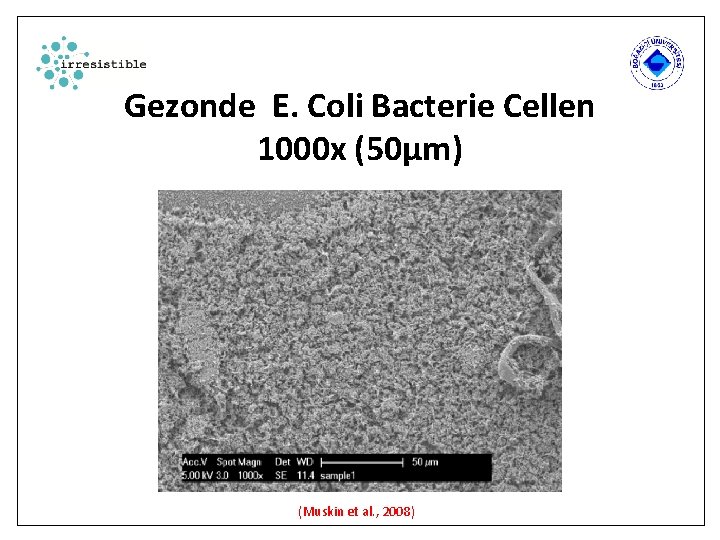 Gezonde E. Coli Bacterie Cellen 1000 x (50µm) (Muskin et al. , 2008) 