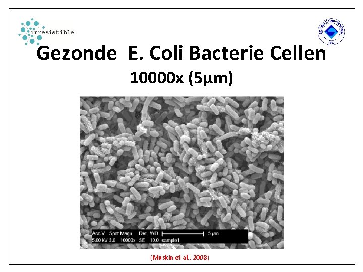 Gezonde E. Coli Bacterie Cellen 10000 x (5µm) (Muskin et al. , 2008) 