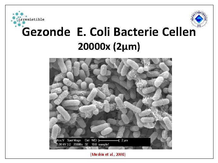 Gezonde E. Coli Bacterie Cellen 20000 x (2µm) (Muskin et al. , 2008) 