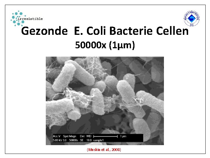 Gezonde E. Coli Bacterie Cellen 50000 x (1µm) (Muskin et al. , 2008) 