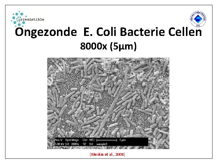 Ongezonde E. Coli Bacterie Cellen 8000 x (5µm) (Muskin et al. , 2008) 