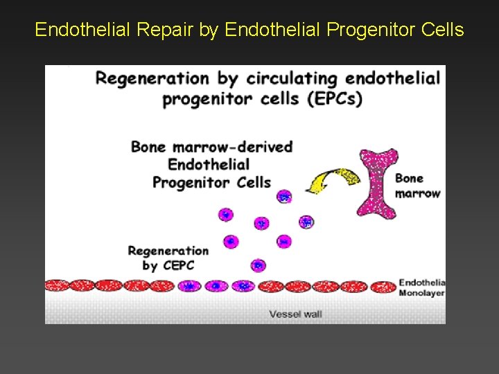 Endothelial Repair by Endothelial Progenitor Cells 