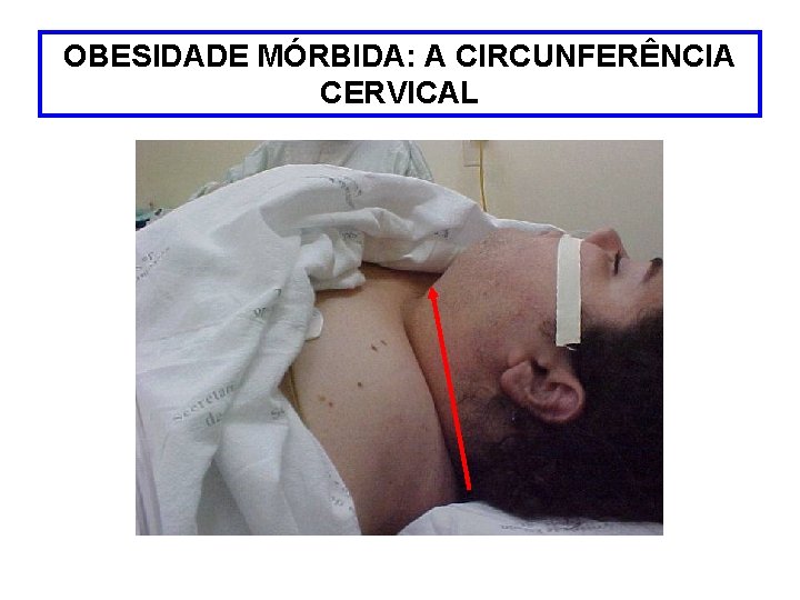 OBESIDADE MÓRBIDA: A CIRCUNFERÊNCIA CERVICAL 