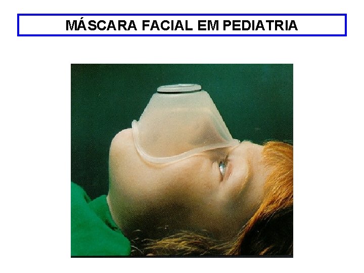 MÁSCARA FACIAL EM PEDIATRIA 