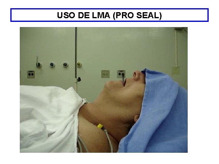 USO DE LMA (PRO SEAL) 