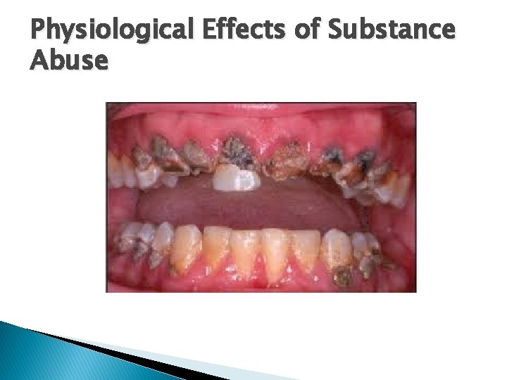 Physiological Effects of Substance Abuse 