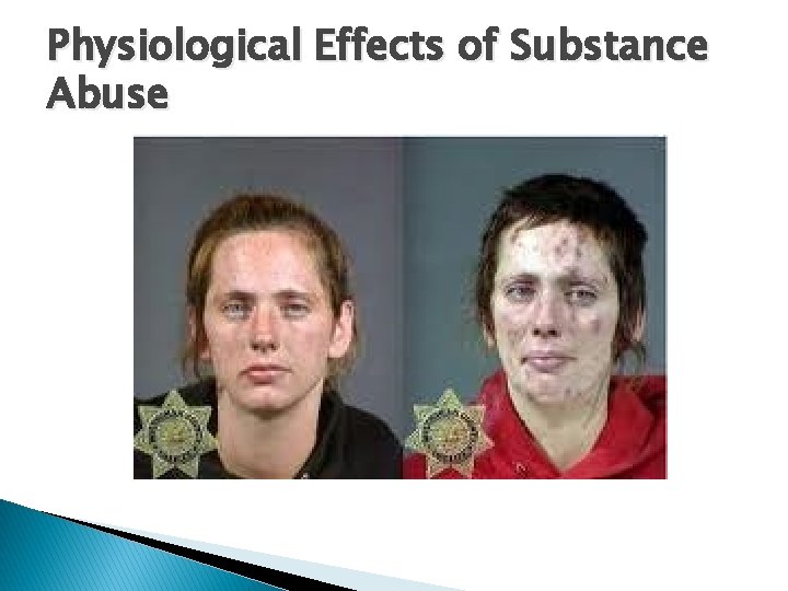 Physiological Effects of Substance Abuse 