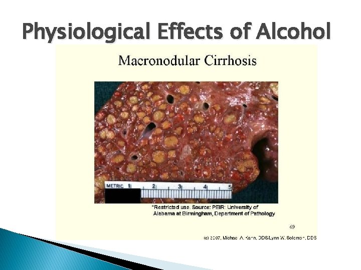 Physiological Effects of Alcohol 