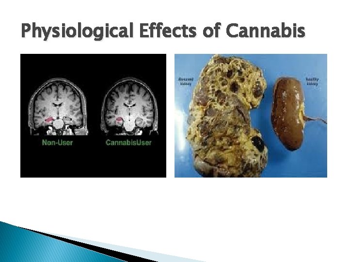 Physiological Effects of Cannabis 