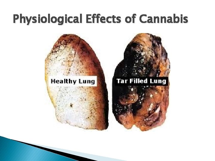 Physiological Effects of Cannabis 