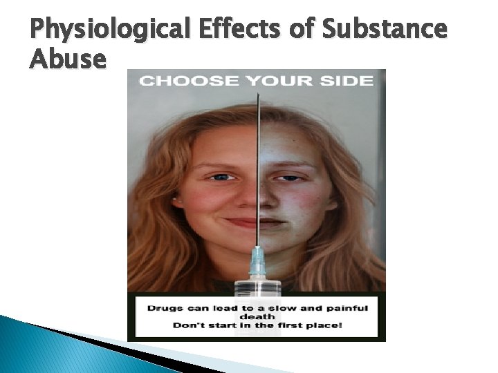 Physiological Effects of Substance Abuse 