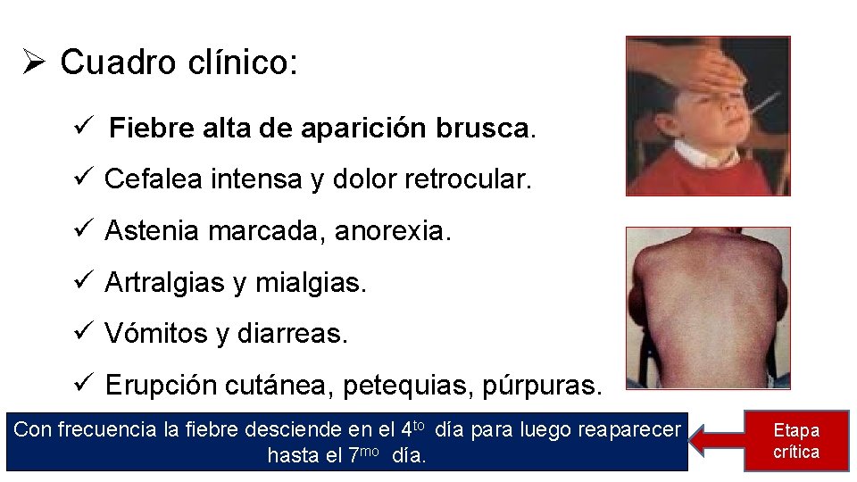 Ø Cuadro clínico: ü Fiebre alta de aparición brusca. ü Cefalea intensa y dolor