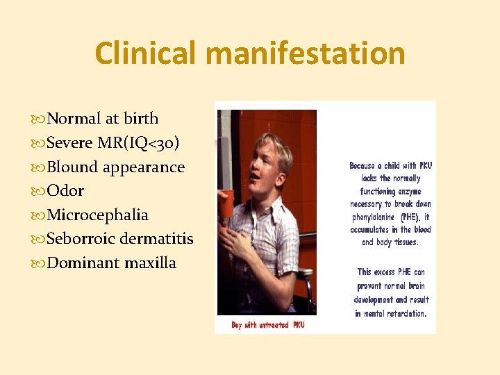 Clinical manifestation Normal at birth Severe MR(IQ<30) Blound appearance Odor Microcephalia Seborroic dermatitis Dominant