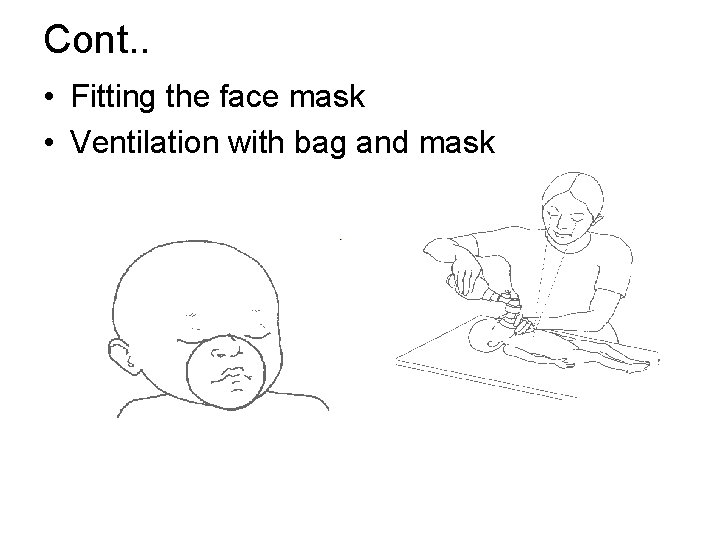 Cont. . • Fitting the face mask • Ventilation with bag and mask 