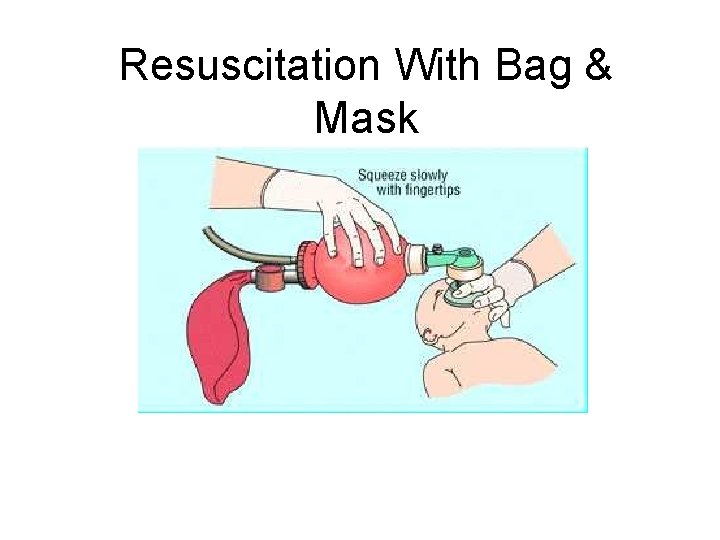 Resuscitation With Bag & Mask 