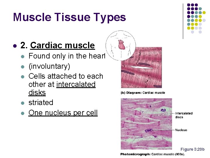 Muscle Tissue Types l 2. Cardiac muscle l l l Found only in the Muscle Tissue Types l 2. Cardiac muscle l l l Found only in the
