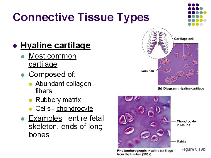 Connective Tissue Types l Hyaline cartilage l l Most common cartilage Composed of: l Connective Tissue Types l Hyaline cartilage l l Most common cartilage Composed of: l