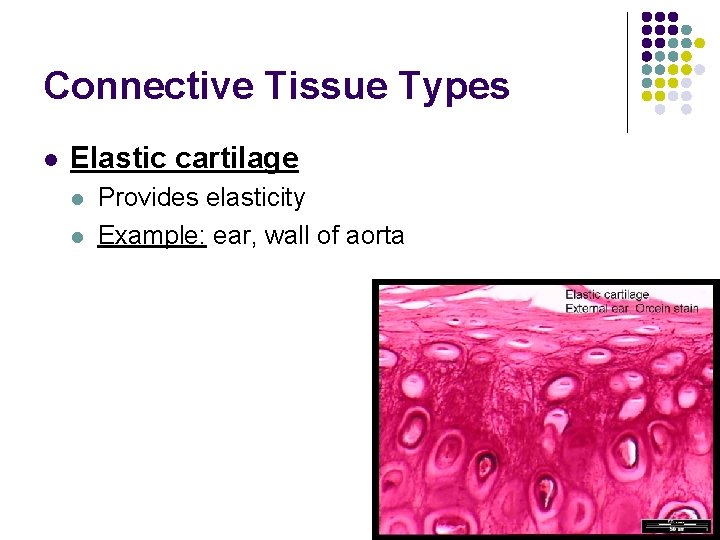 Connective Tissue Types l Elastic cartilage l l Provides elasticity Example: ear, wall of Connective Tissue Types l Elastic cartilage l l Provides elasticity Example: ear, wall of