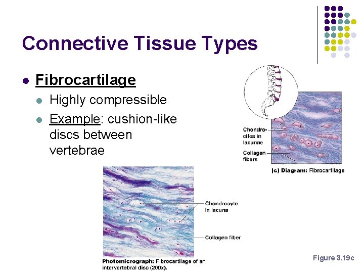 Connective Tissue Types l Fibrocartilage l l Highly compressible Example: cushion-like discs between vertebrae Connective Tissue Types l Fibrocartilage l l Highly compressible Example: cushion-like discs between vertebrae