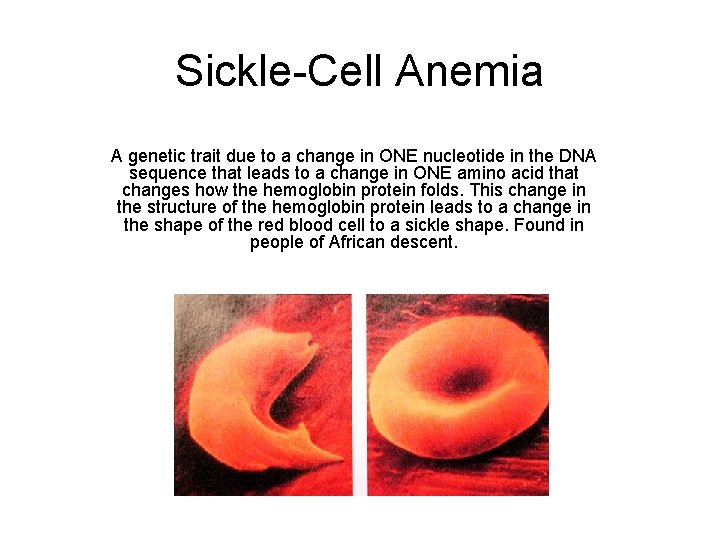 Sickle-Cell Anemia A genetic trait due to a change in ONE nucleotide in the