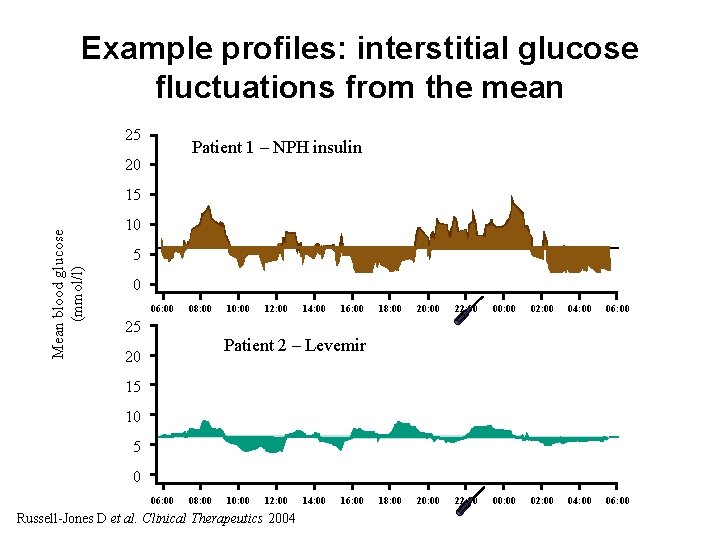 Example profiles: interstitial glucose fluctuations from the mean 25 Patient 1 – NPH insulin