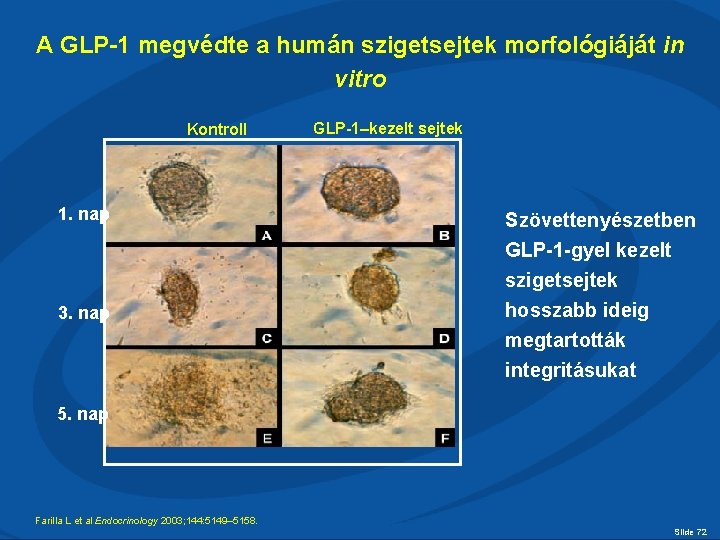 A GLP-1 megvédte a humán szigetsejtek morfológiáját in vitro Kontroll 1. nap 3. nap