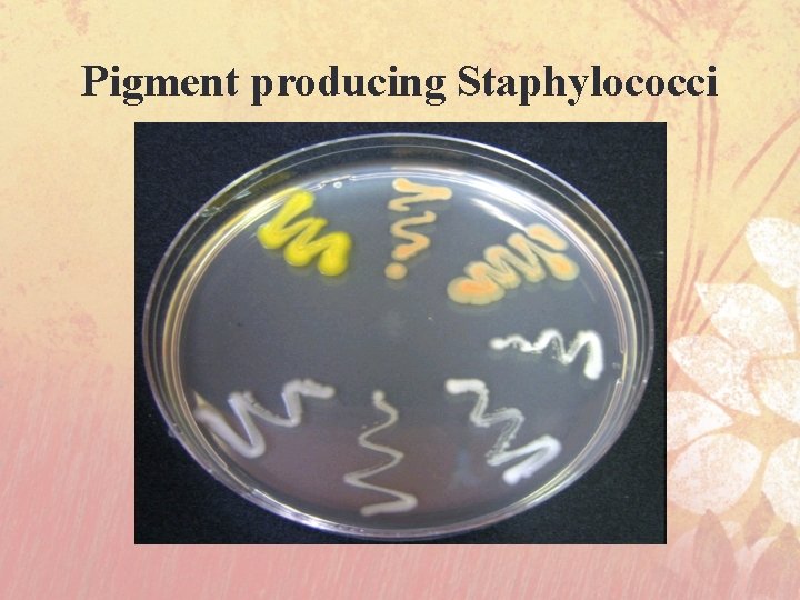 Pigment producing Staphylococci 