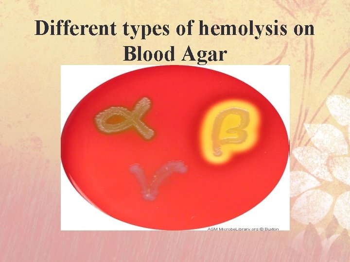 Different types of hemolysis on Blood Agar 