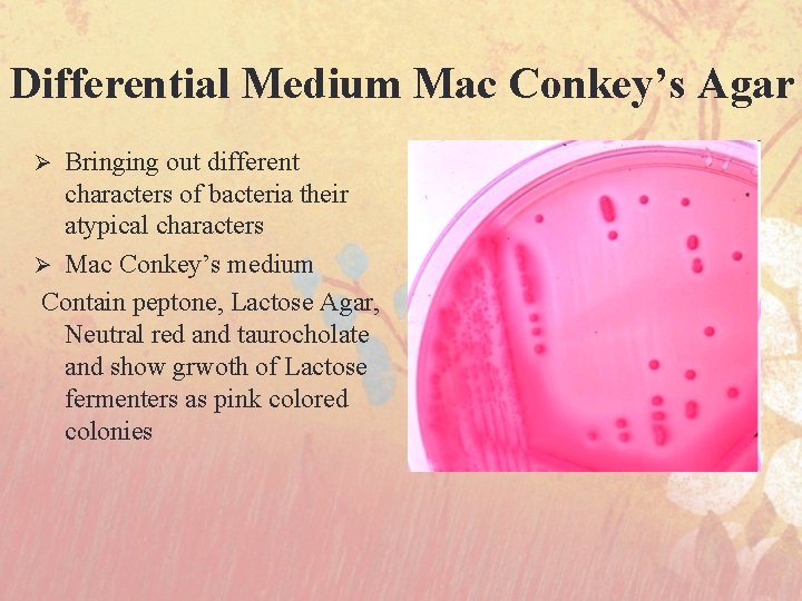 Differential Medium Mac Conkey’s Agar Bringing out different characters of bacteria their atypical characters