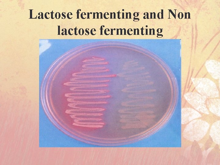 Lactose fermenting and Non lactose fermenting 