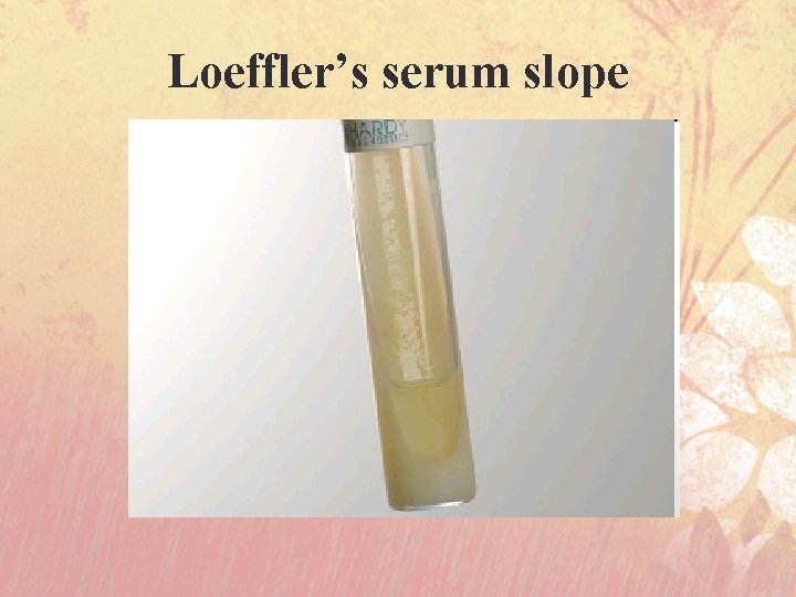 Loeffler’s serum slope 