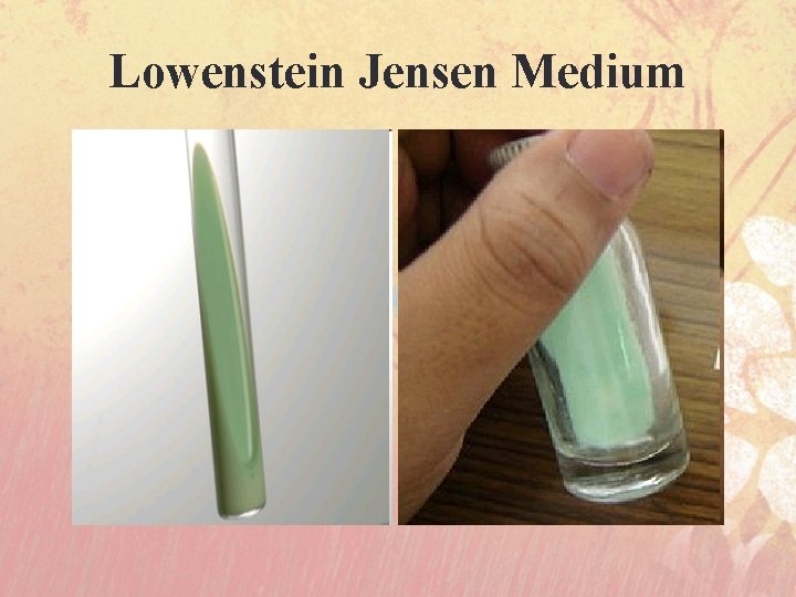 Lowenstein Jensen Medium 