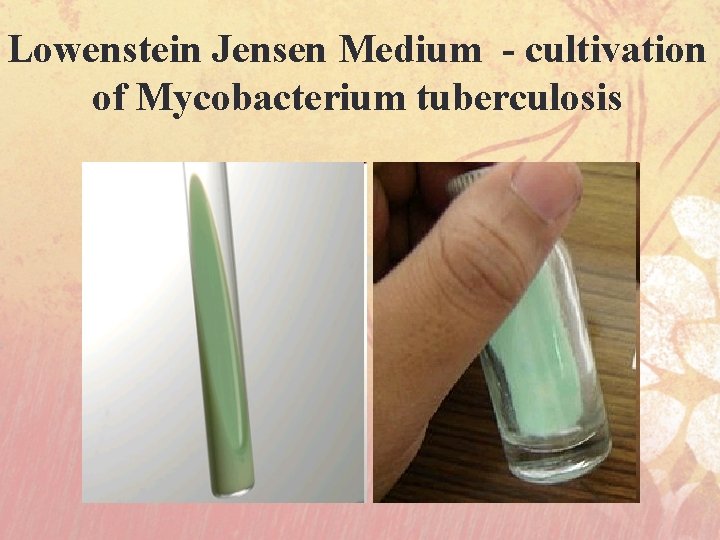 Lowenstein Jensen Medium - cultivation of Mycobacterium tuberculosis 