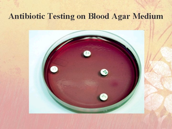 Antibiotic Testing on Blood Agar Medium 