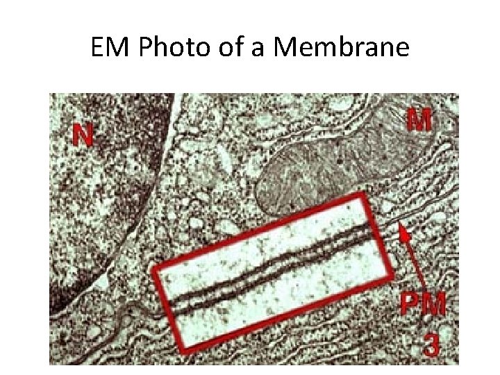 EM Photo of a Membrane EM Photo of a Membrane