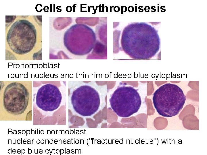 Cells of Erythropoisesis Pronormoblast round nucleus and thin rim of deep blue cytoplasm Basophilic