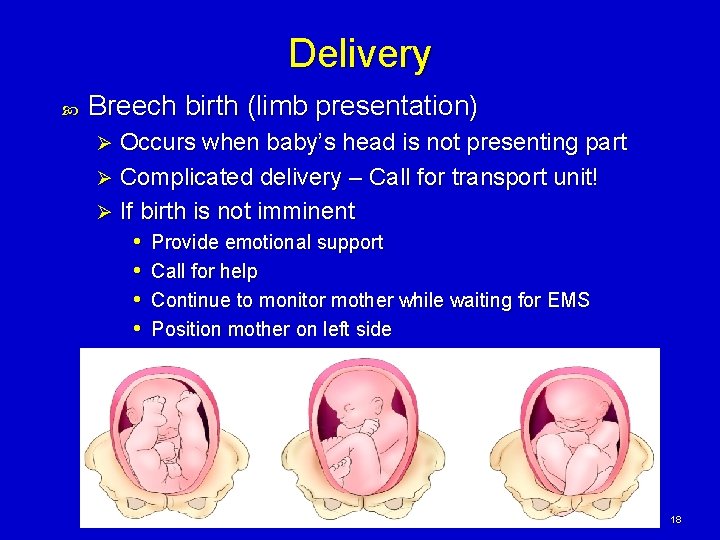 Delivery Breech birth (limb presentation) Occurs when baby’s head is not presenting part Ø Delivery Breech birth (limb presentation) Occurs when baby’s head is not presenting part Ø